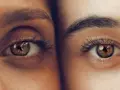 Ojos hundidos antes y después. Comparación de dos ojos, uno con ojeras marcadas y otro con piel más lisa y luminosa.
