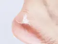Primer plano de un talón con piel seca y descamada, mostrando por qué se pelan los pies.