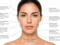 Mujer con zonas faciales marcadas, indicando problemas de piel y posibles tratamientos de radiofrecuencia.