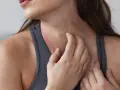 Mujer rascándose el cuello, mostrando varios tipos de manchas en el cuello, posiblemente por irritación o alergia.