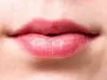 Labios rosados y agrietados, con signos de labios quemados por el sol.