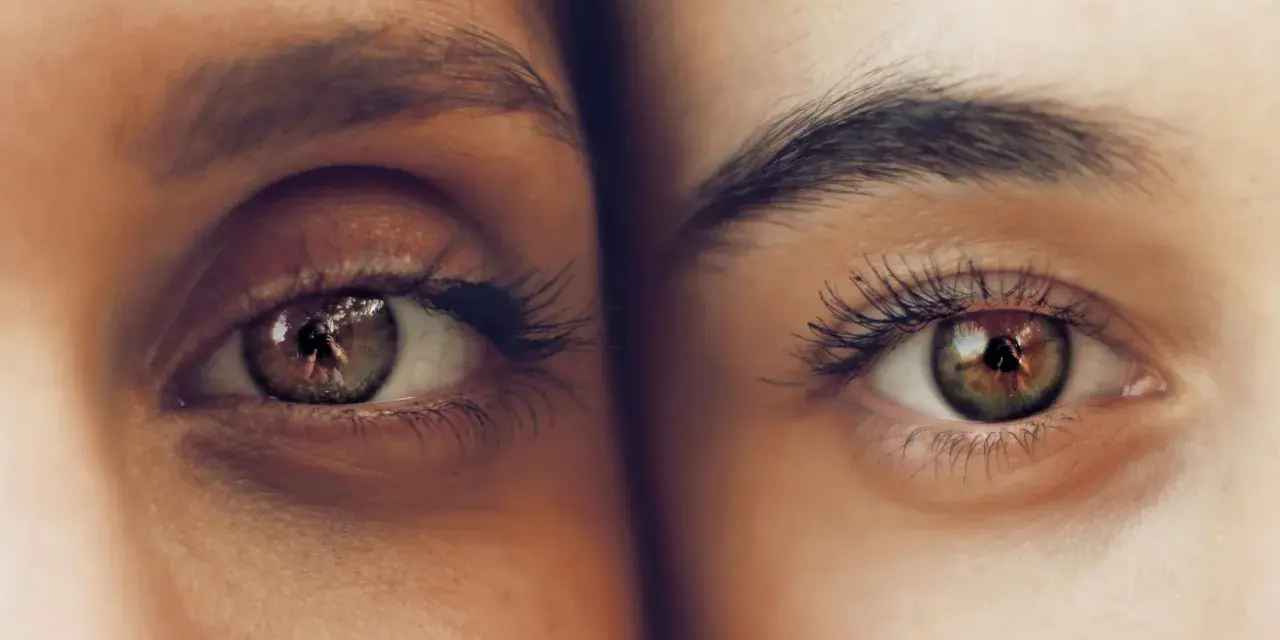 Ojos hundidos antes y después. Comparación de dos ojos, uno con ojeras marcadas y otro con piel más lisa y luminosa.