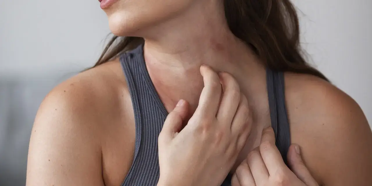 Mujer rascándose el cuello, mostrando varios tipos de manchas en el cuello, posiblemente por irritación o alergia.