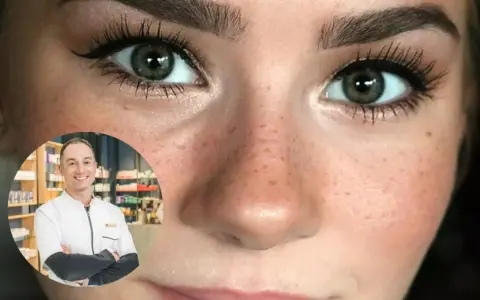 Un farmacéutico sonriente explica que se puede usar despigmentante en verano para unificar el tono de la piel.