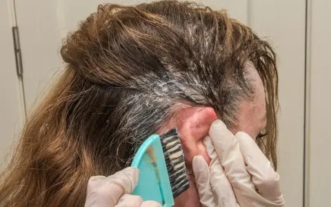 Manos enguantadas aplican tinte en el cabello. Si te manchas la piel, aprende como quitar el tinte de la piel fácilmente.