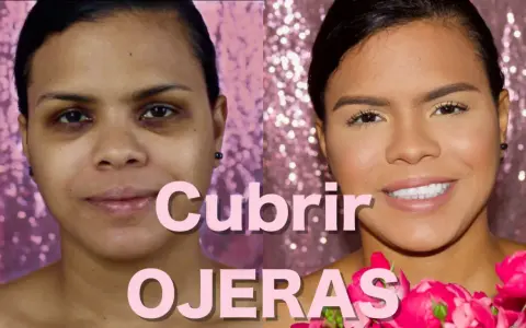 Antes y después: aprende como disimular las ojeras oscuras sin maquillaje. Rostro radiante con flores rosas.