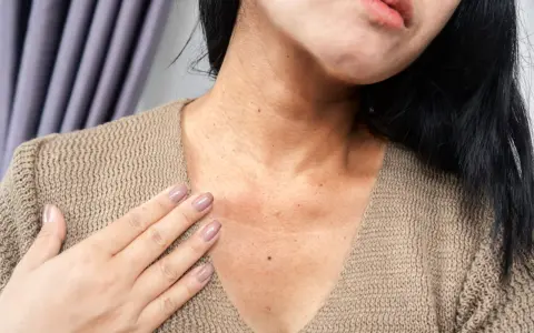 Una mujer se toca el cuello, mostrando pecas negras en la cara y el escote, con un suéter beige.