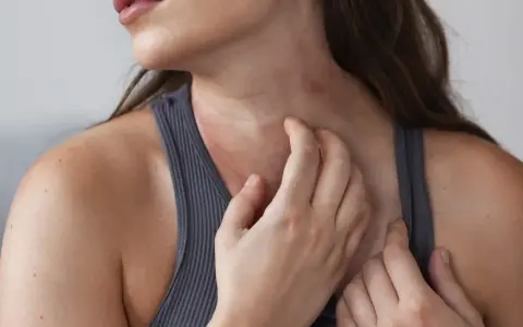 Mujer rascándose el cuello, mostrando varios tipos de manchas en el cuello, posiblemente por irritación o alergia.