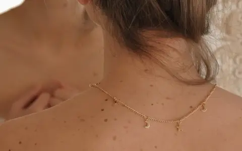 Espalda con lunares y un collar dorado con estrellas y lunas. Me pregunto porque me salen granos en la espalda.