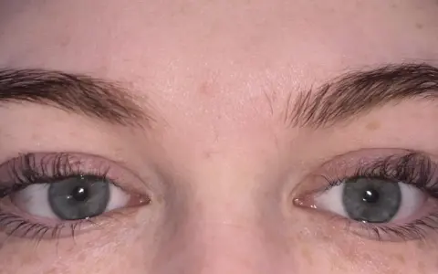 Ojos con lifting de pestañas mal hechas. Las pestañas lucen desordenadas y poco naturales, buscando una solución para corregir el resultado.
