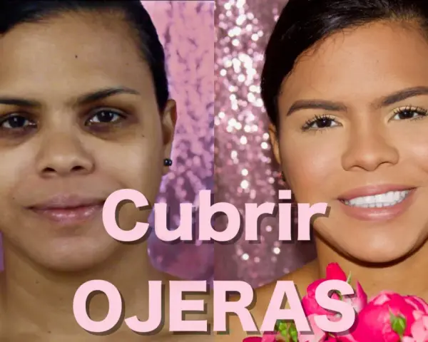 Antes y después: aprende como disimular las ojeras oscuras sin maquillaje. Rostro radiante con flores rosas.