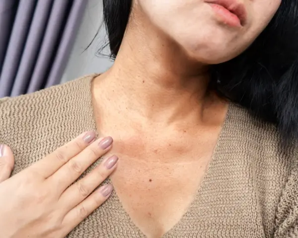 Una mujer se toca el cuello, mostrando pecas negras en la cara y el escote, con un suéter beige.