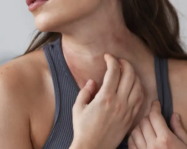 Mujer rascándose el cuello, mostrando varios tipos de manchas en el cuello, posiblemente por irritación o alergia.