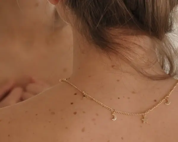 Espalda con lunares y un collar dorado con estrellas y lunas. Me pregunto porque me salen granos en la espalda.