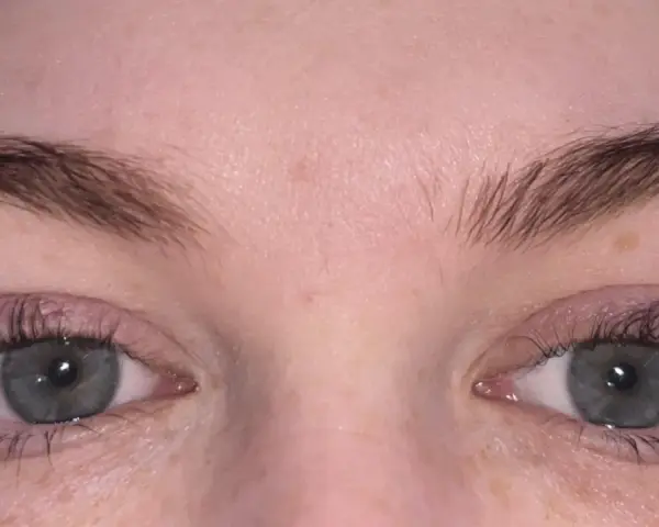 Ojos con lifting de pestañas mal hechas. Las pestañas lucen desordenadas y poco naturales, buscando una solución para corregir el resultado.