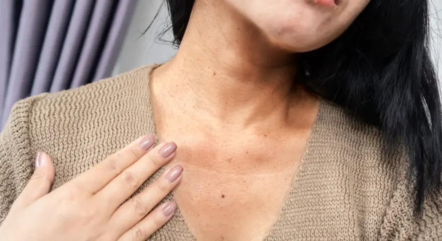 Una mujer se toca el cuello, mostrando pecas negras en la cara y el escote, con un suéter beige.