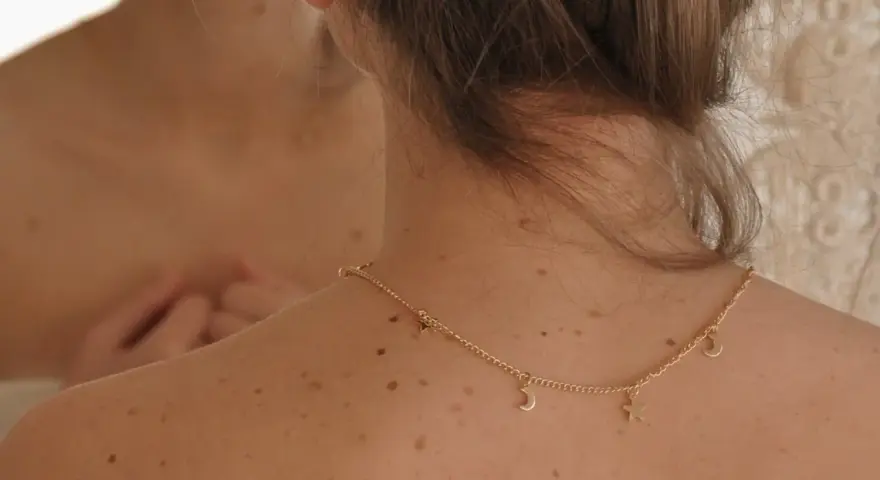Espalda con lunares y un collar dorado con estrellas y lunas. Me pregunto porque me salen granos en la espalda.