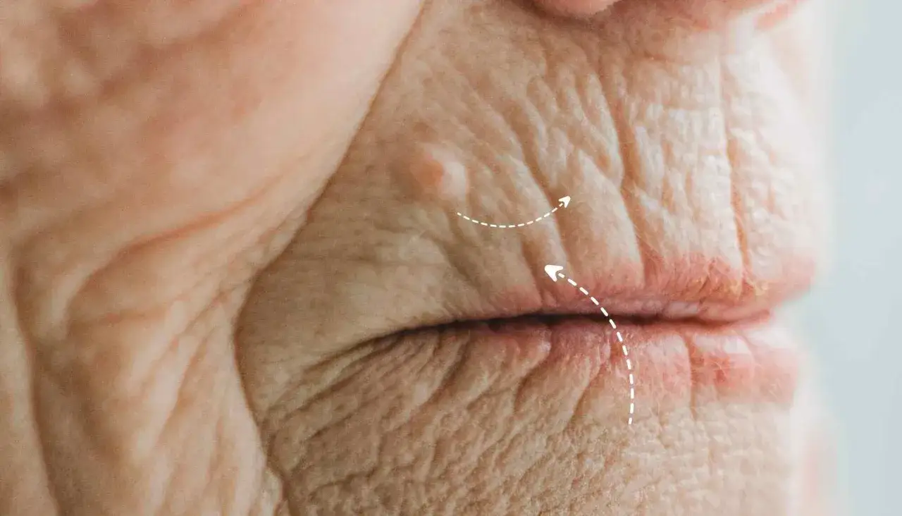 Piel con arrugas alrededor de la boca, mostrando cómo evitar el código de barras en los labios con un pequeño bulto y flechas indicando movimiento.