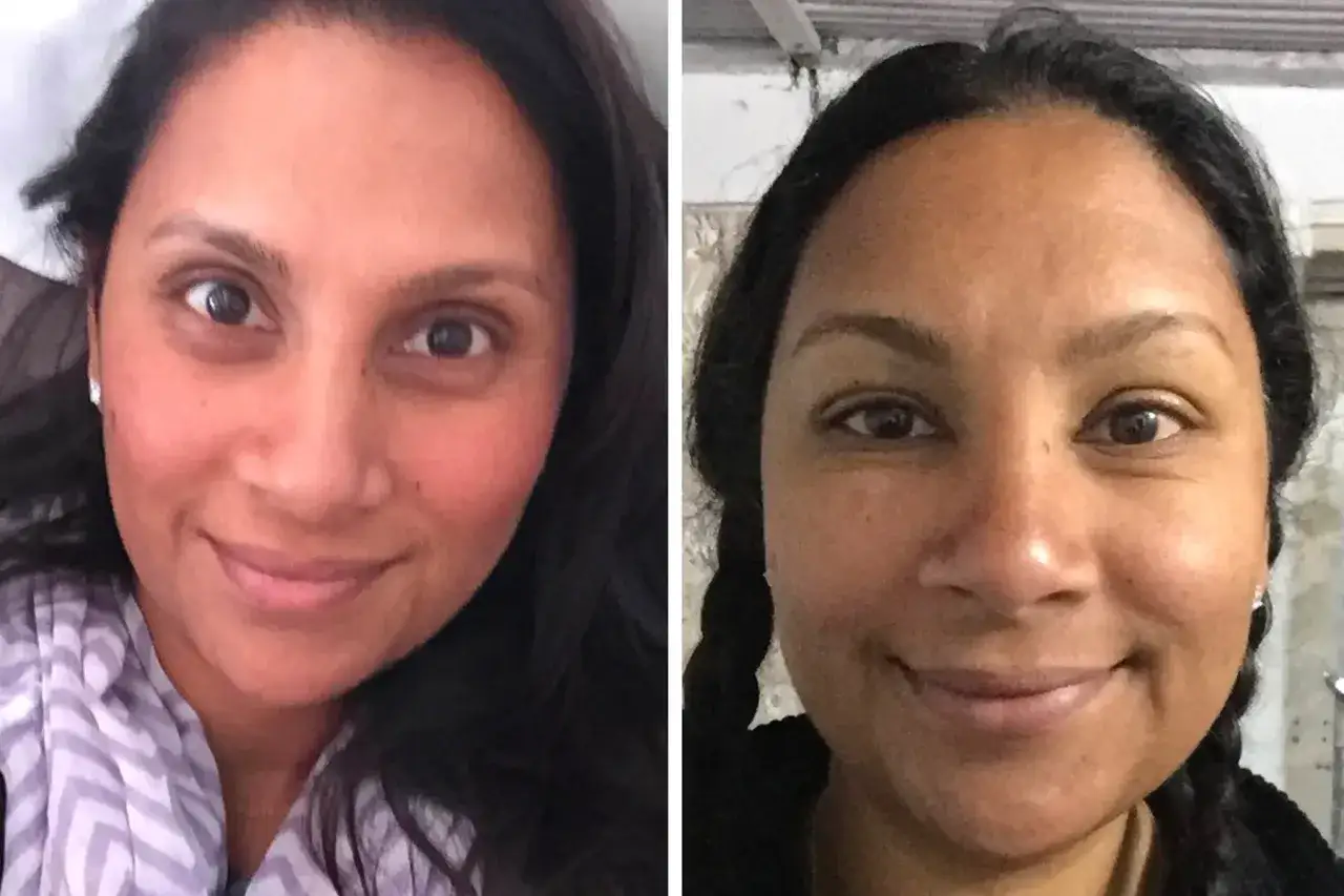 Dos retratos de una mujer. En el primero, su cara hinchada por estrés se ve más pálida. En el segundo, su rostro luce más bronceado y relajado.