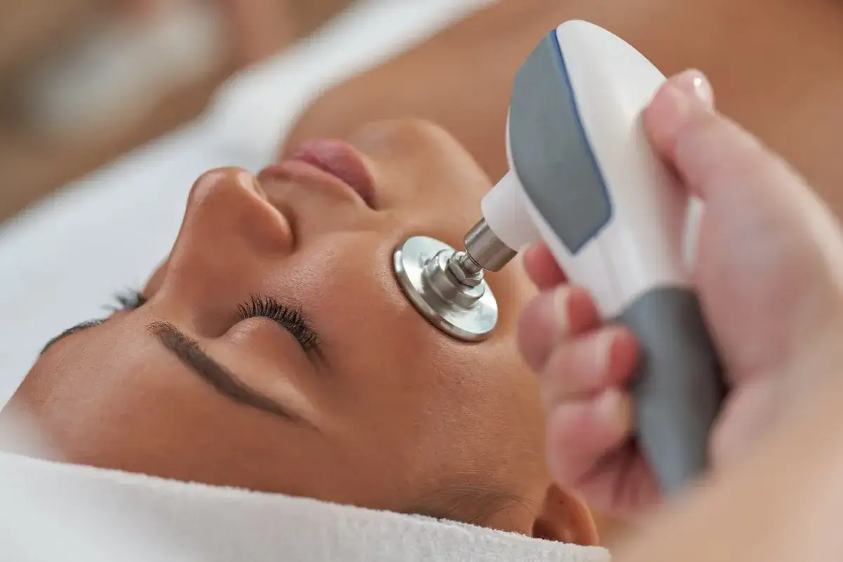 Una mano aplica un dispositivo de radiofrecuencia facial cerca del ojo de una mujer. Averigua cuántas sesiones de radiofrecuencia facial son necesarias para tu piel.