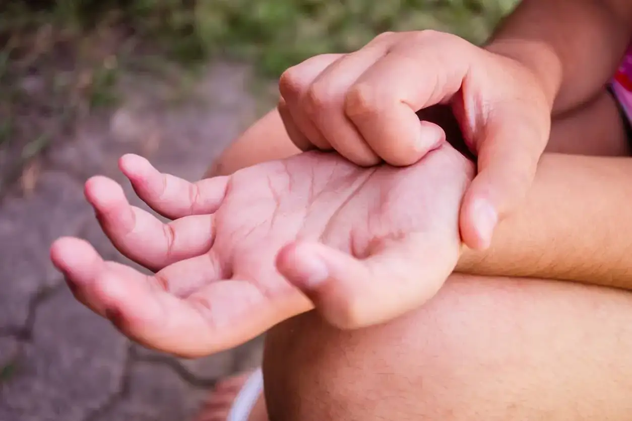 Persona se rasca la mano, sintiendo un molesto picor en las manos.