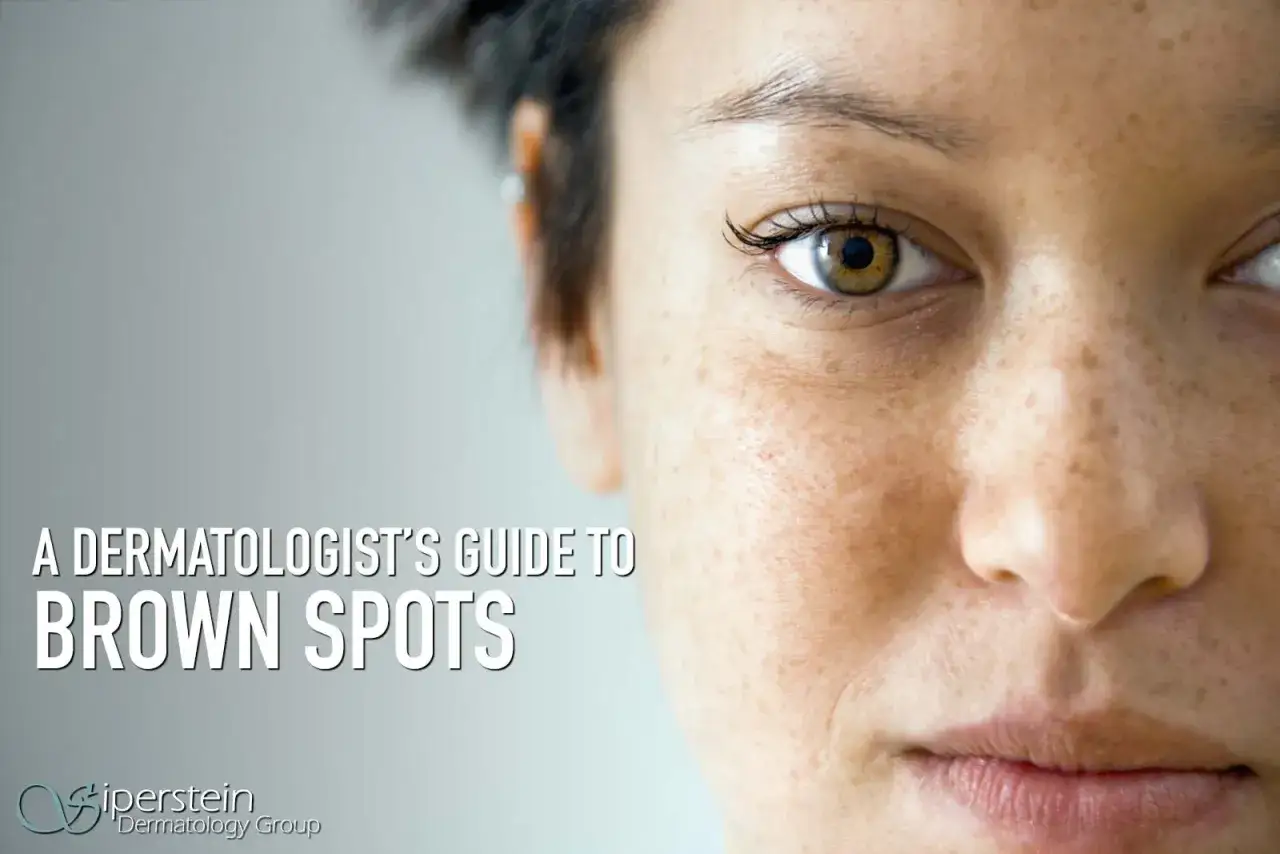 Primer plano de un rostro con pecas negras. Texto: